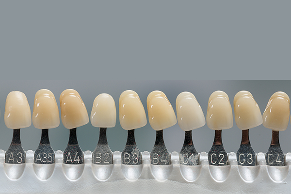 Here are different color of porcelain veneers